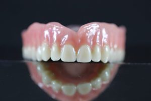 dentures-anderson
