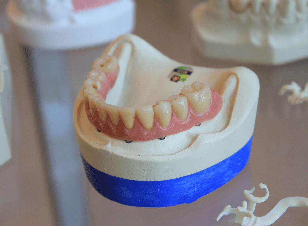 bottom jaw dentures in dentists office