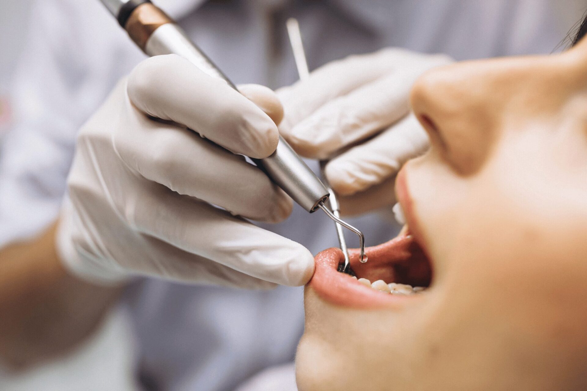 dentist performing dental filling procedure